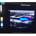 Kardiale tragbare Farbdoppler-Ultraschall-Maschinen-Preis-medizinische Sonar 2D 3D Echokardiographie Ecografo USD Echo-Maschine 4D